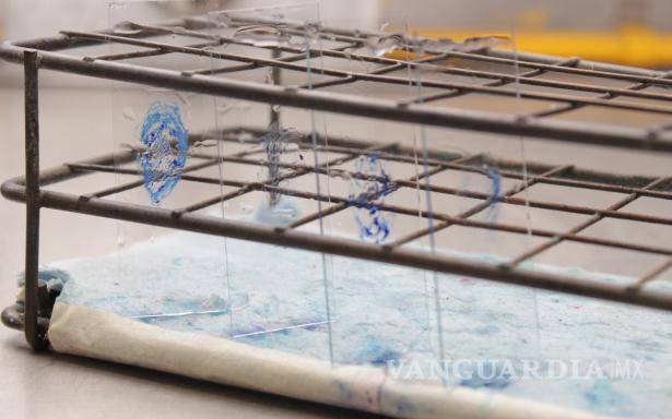 $!A través de estudios de baciloscopia se detecta la tuberculosis en etapa temprana.