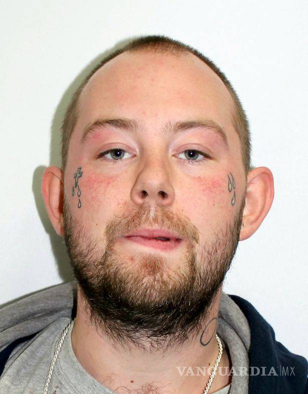 $!Modelo comparte foto de su recuperación tras ser vapuleada con ácido que deformó su rostro