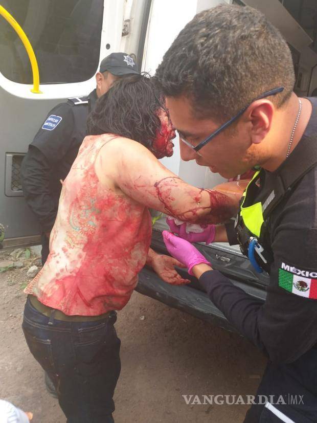 $!Dos mujeres fueron atacadas por manada de perros en Texcoco