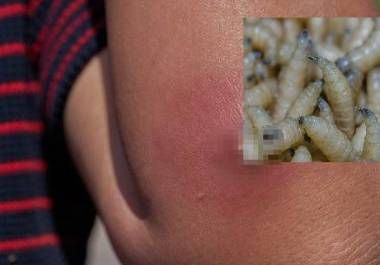 Refuerzan acciones de educación sanitaria en comunidades, principalmente para promover la detección temprana de posibles casos.