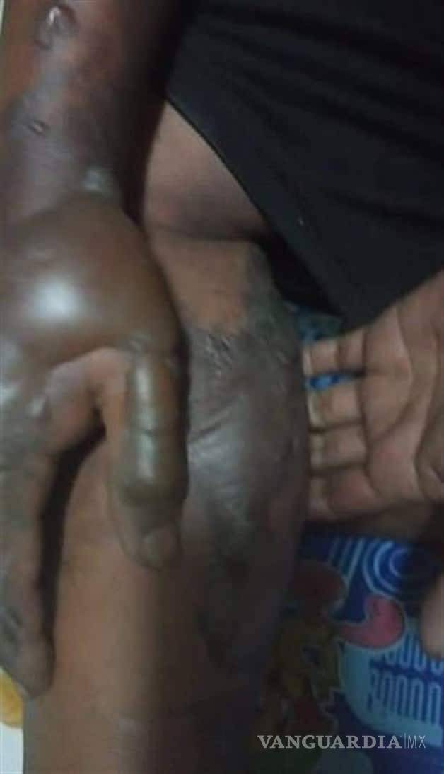 $!'Broma' de niños deja a vendedor de globos envuelto en llamas