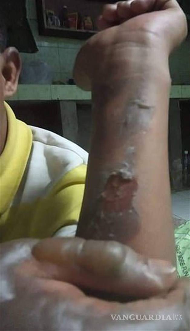 $!'Broma' de niños deja a vendedor de globos envuelto en llamas