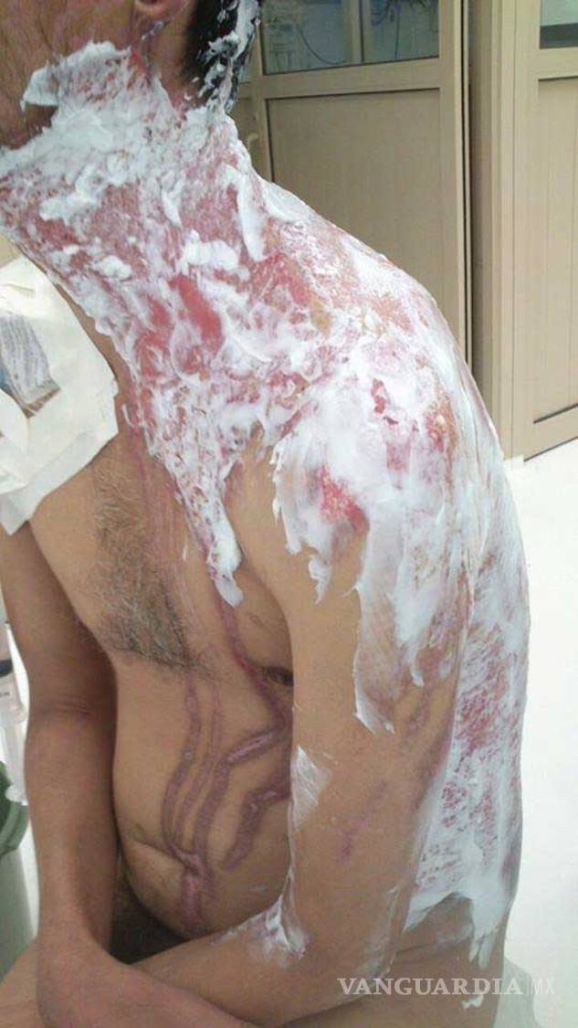 $!Rigo, el hombre con alma de niño que quemaron vivo en Cuatrociénegas