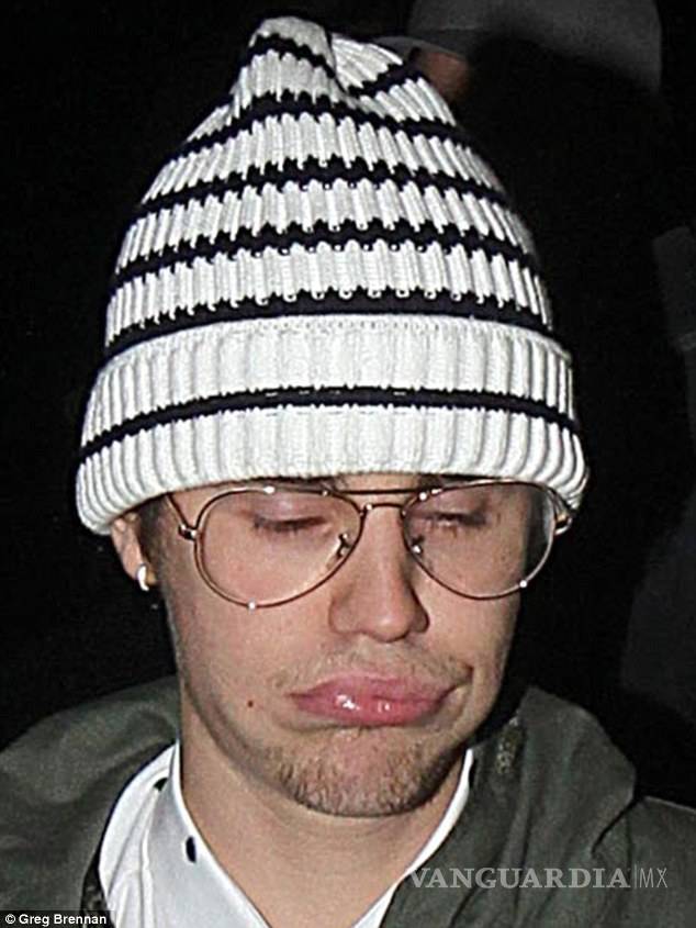 $!Terrible aspecto de Justin Bieber luego de una fiesta de Usain Bolt