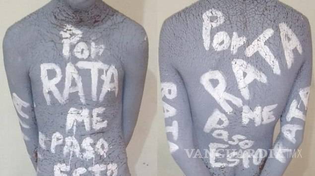 'Esto me pasa por rata'... joven de 15 años es torturado por comando armado y le amputan las dos manos en Veracruz