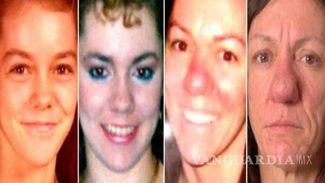 $!Como Pinocho: La nariz de esta mujer no deja de crecer