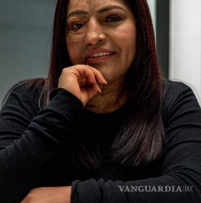 $!Por medio de la organización que lleva su nombre, Carmen Sánchez ha abogado por las mujeres víctimas de ataques con ácido.