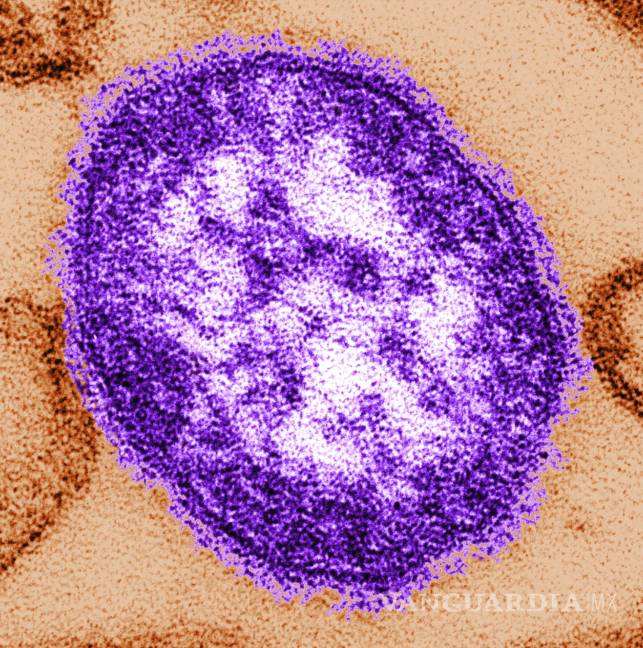 $!Una imagen de microscopio electrónico de una partícula del virus del sarampión. Los brotes de sarampión en EU están aumentando la preocupación de los expertos.