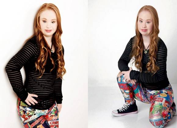 Madeline Stuart la modelo con síndrome de Down conquista la pasarela en NY