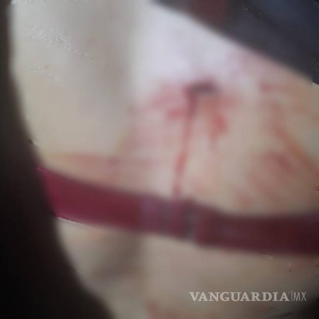 Detienen a hombre por herir con un cuchillo a su pareja, en Nuevo León