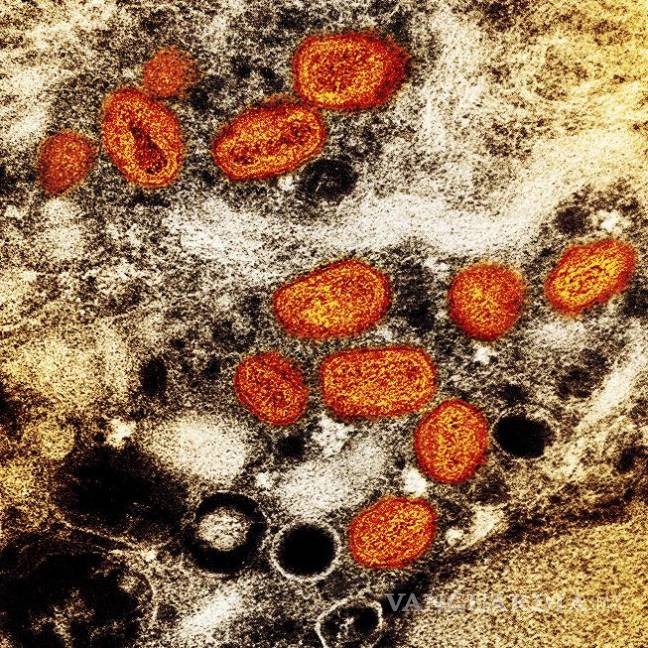 $!Imagen captada en el que se ven partículas de viruela símica, en anaranjado, encontradas dentro de una célula infectada (marrón) cultivada en un laboratorio.