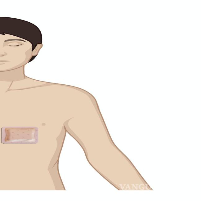 $!Ilustración del dispositivo ECG adherido al pecho de un paciente.