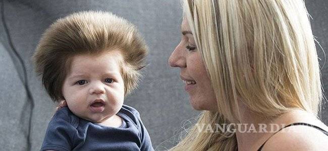 $!¿Por qué algunos bebés nacen calvos y otros con cabello?