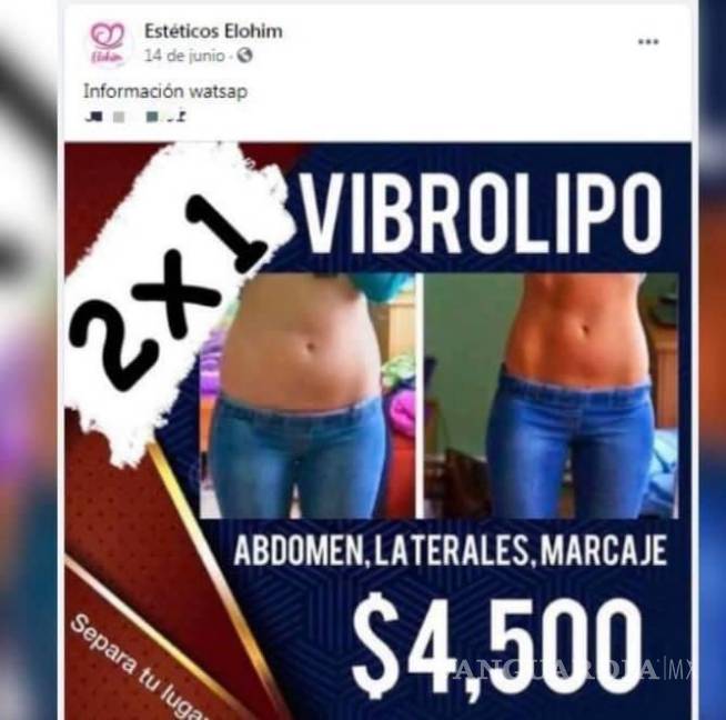 $!Clínica donde falleció Cinthia ofrecía liposucción al 2X1 por 4 mil pesos