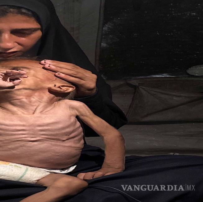 $!La crisis por desnutrición en Gaza ganó visibilidad con imágenes como las del pequeño Mohamed Motawaq.