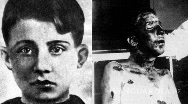 $!Anteo Zamboni, el niño que casi asesina a Benito Mussolini y &quot;no duró vivo ni un minuto y medio&quot;