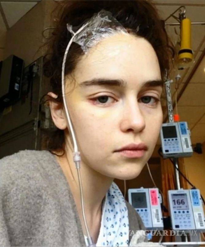 $!Emilia Clarke de Game of Thrones casi pierde la vida y compartió fotos del suceso