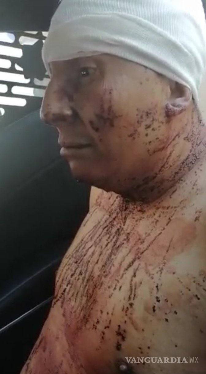 $!Fotos de Ingrid, desollada y asesinada por su pareja, fueron filtradas; estalla indignación