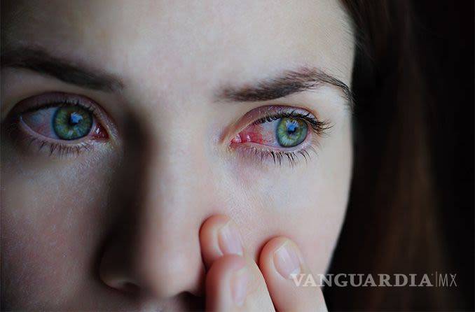 Comezón y dolor de ojos podría ser síntoma temprano de COVID-19