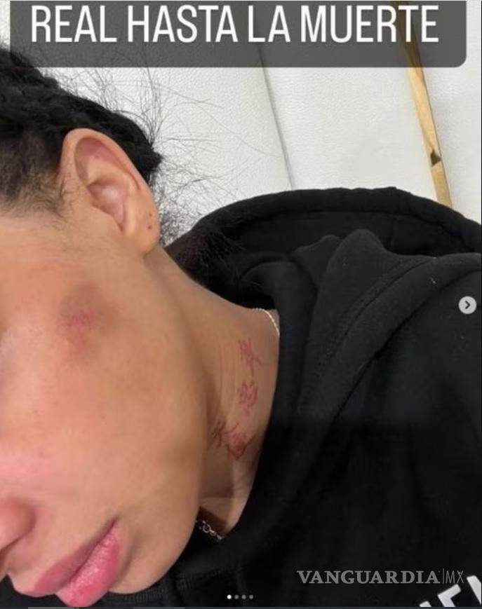 $!Yailin publicó una foto como evidencia de la violencia que sufrió.