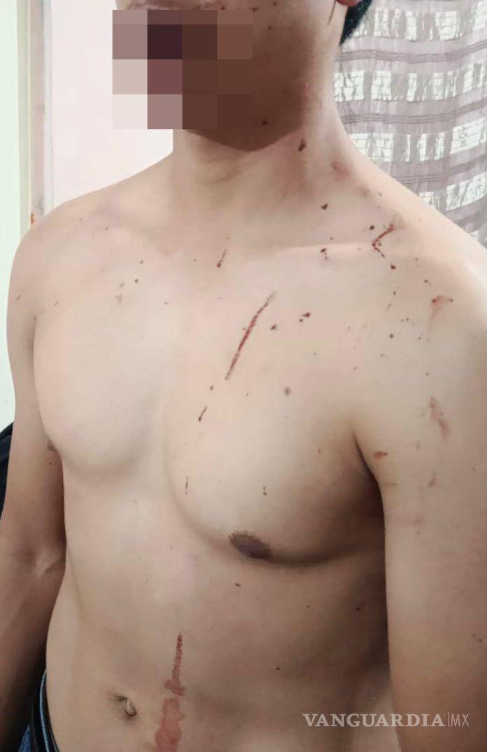 $!El joven presentó diversas heridas tras ser golpeado por dos sujetos durante el asalto en calles de la colonia La Valencia.