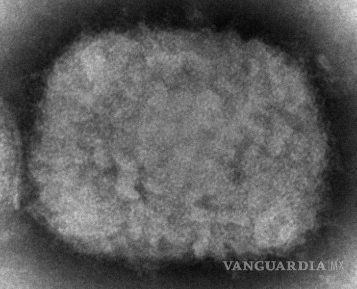 $!Esta imagen de microscopio de 2003 que muestra un virión del virus de la viruela símica o del mono obtenido de una muestra relacionada con un brote en perros.