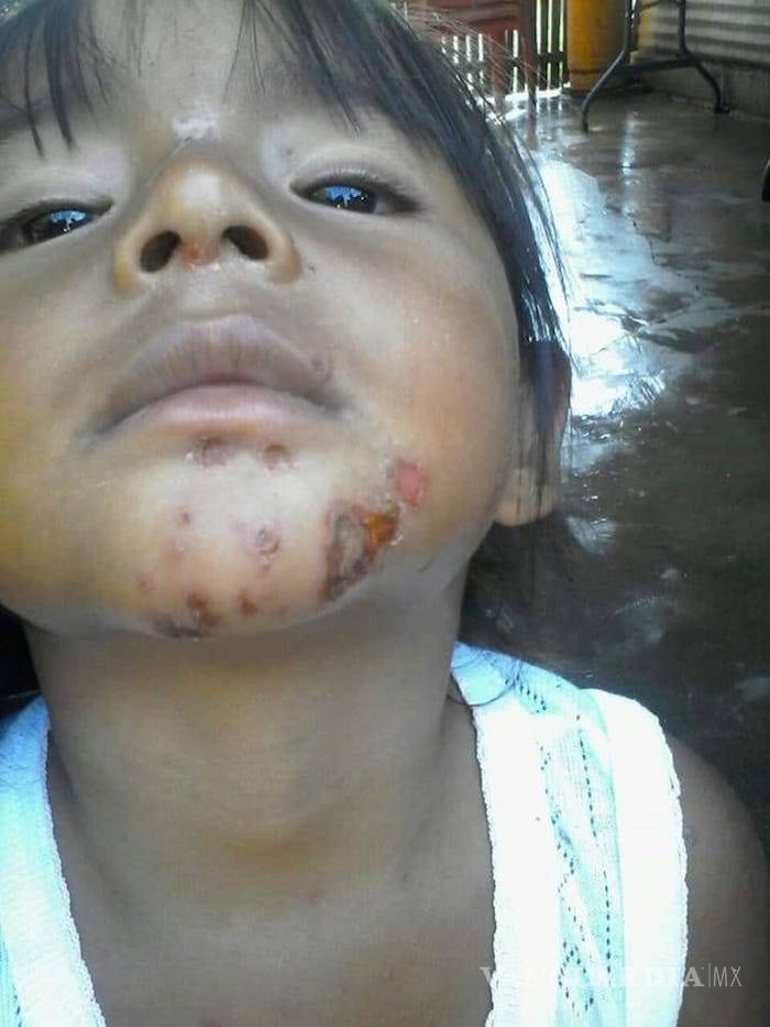 $!Es Pemex; afecta el agua, mata a los manatíes y daña la salud de la gente: pescadores de Tabasco