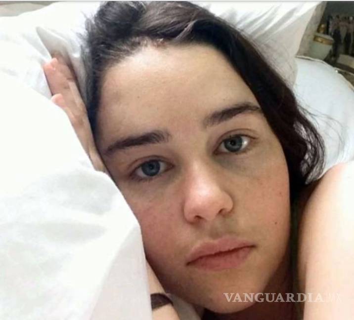 $!Emilia Clarke de Game of Thrones casi pierde la vida y compartió fotos del suceso