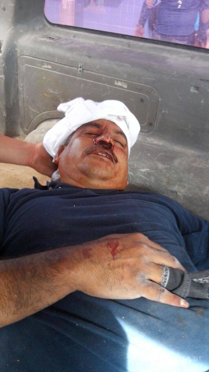 $!Se enfrentan en riña policías de Gómez Palacio y pobladores por planta de cianuro Chemours