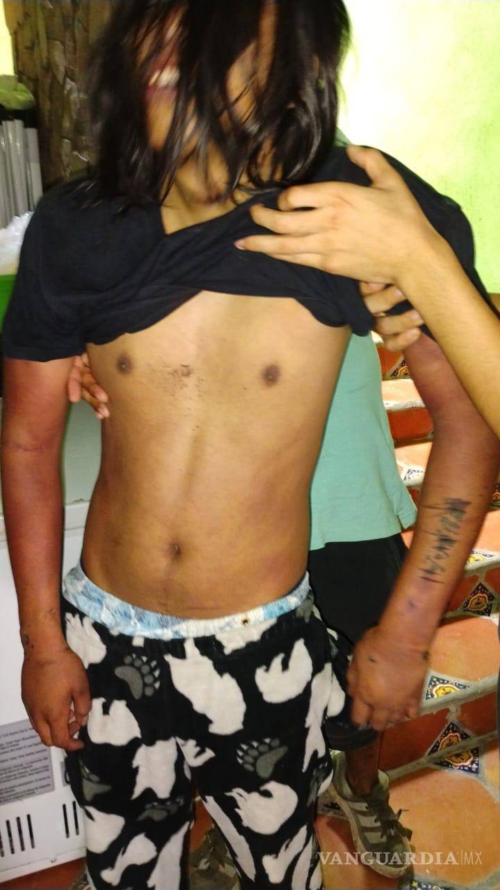 $!La familia del joven le tomó fotos a las lesiones presentadas.