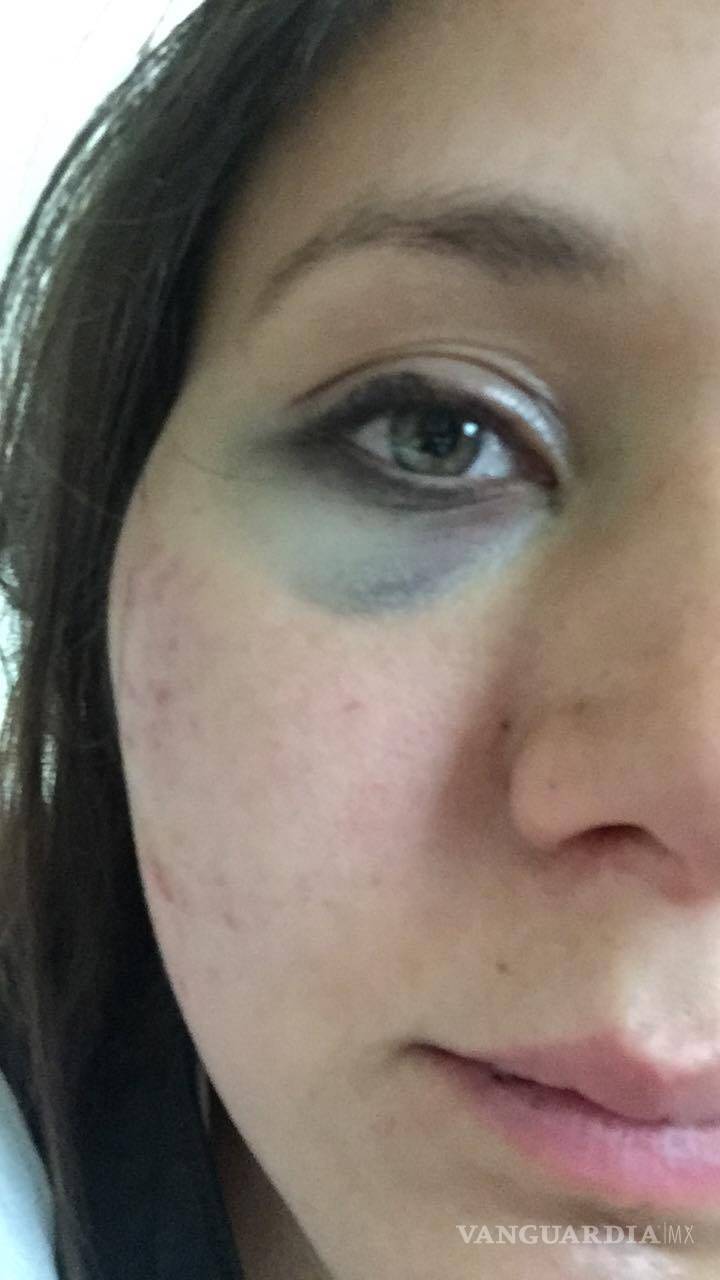 $!Se vuelve viral denuncia de saltillense golpeada por ‘cortar’ a su novio