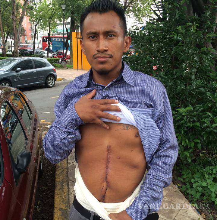 $!“Un balazo me afectó el bazo, el hígado, el pulmón izquierdo y el riñón”: Heridos de Nochixtlán