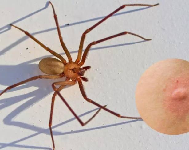 Especialistas recomendaron reforzar medidas de prevención en los hogares, como fumigaciones periódicas y revisión de espacios cerrados.