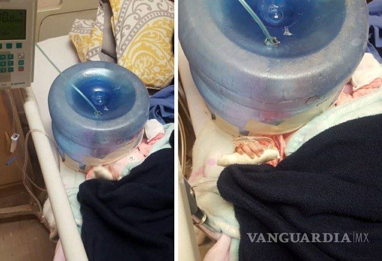 $!Hospital de Sonora usó un garrafón como casco de oxígeno para bebé