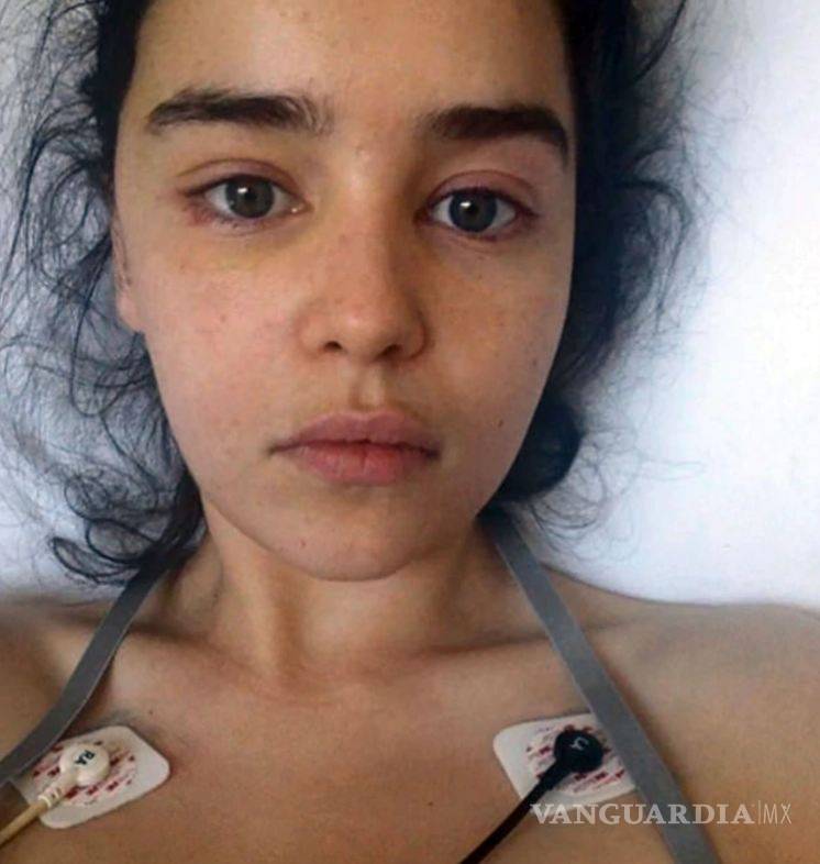 $!Emilia Clarke de Game of Thrones casi pierde la vida y compartió fotos del suceso