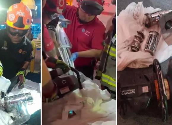 Bebé de un año pierde la mano y antebrazo en accidente con máquina moledora de carne en Galeana, Nuevo León