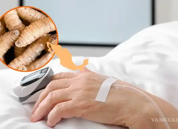 Confirman en México segundo caso de gusano barrenador en un humano