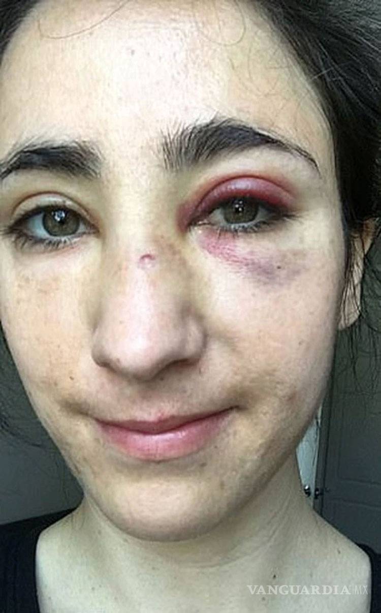 $!Golpean brutalmente a azafata y su novia en autobús de Londres, querían obligarlas a besarse