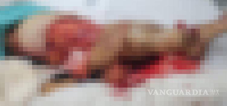 $!Familiares de Aglaé ¨N¨ esperan avances mientras la mujer permanece grave en el hospital.