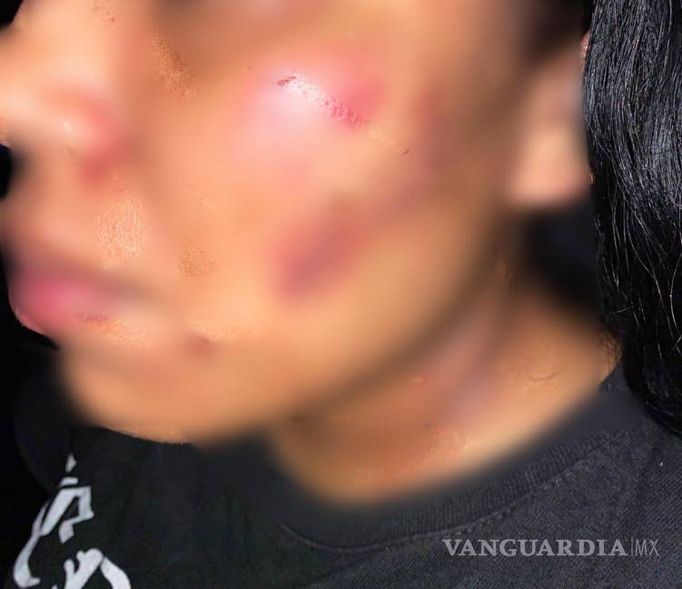 Nuevo León: Policías de Guadalupe evitan feminicidio y arrestan a agresor