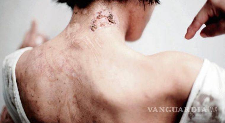 La escalofriante historia de Zunduri, 'la esclava de la tintorería'