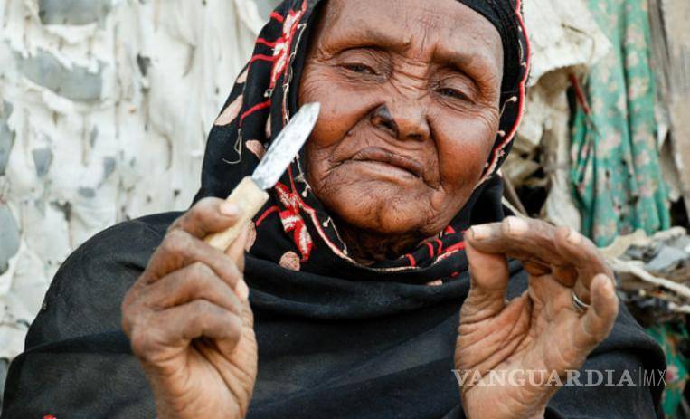 $!La mutilación genital femenina se resiste a irse