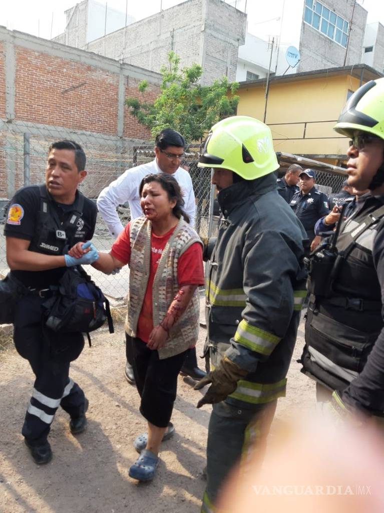 $!Dos mujeres fueron atacadas por manada de perros en Texcoco