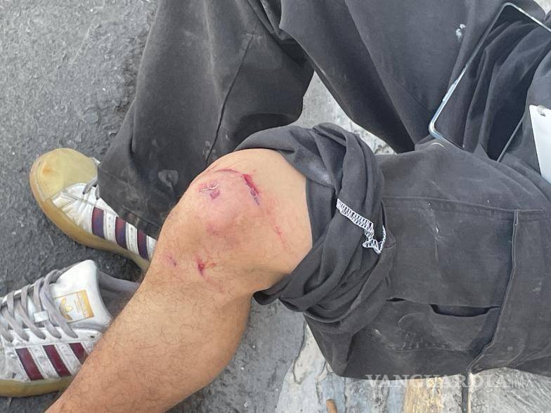 $!El joven motociclista, sufrió lesiones en su rodilla.