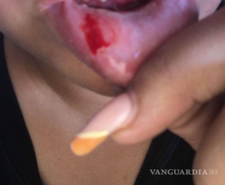 Paramédico de la Cruz Roja de Saltillo viola orden de restricción y agrede a ex pareja