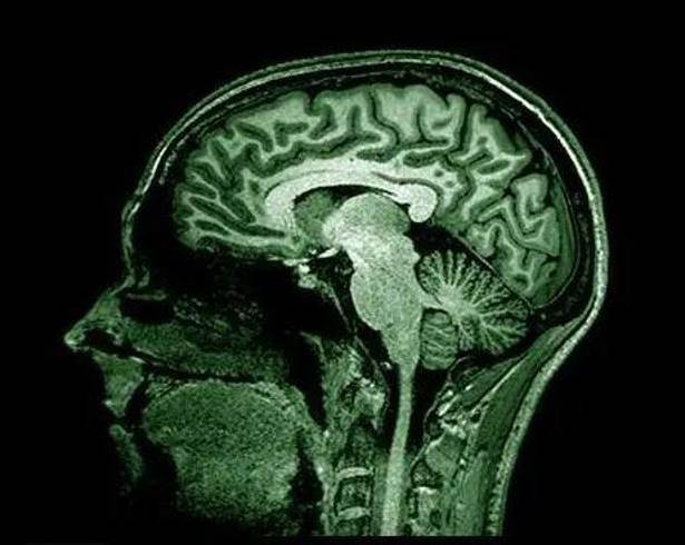 Los investigadores descubrieron que un mal funcionamiento del sistema que se encarga de limpiar el cerebro podría ser la causa de diversas patologías neurodegenerativas, tales como el alzhéimer.
