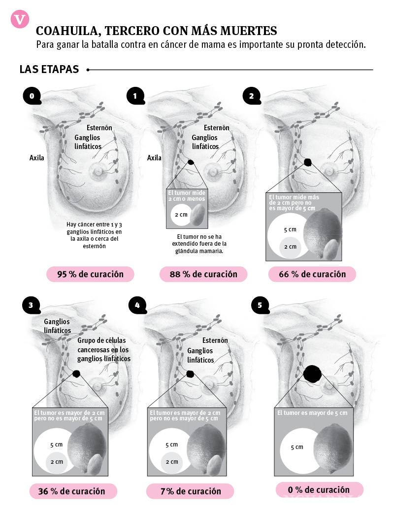 $!Bajan muertes por cáncer de mama en Coahuila