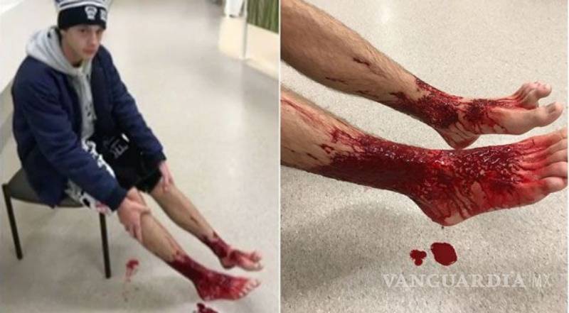$!Misteriosas criaturas marinas causan heridas a joven en Australia