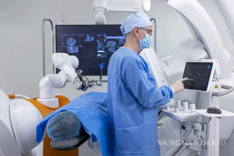 $!Las nuevas características del sistema robótico Epione incluyen capacidades de IA mejoradas y compatibilidad lo que permite una mayor movilidad.