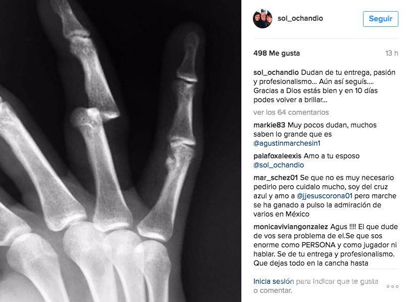 $!Marchesín se fracturó el dedo; su esposa lo confirma